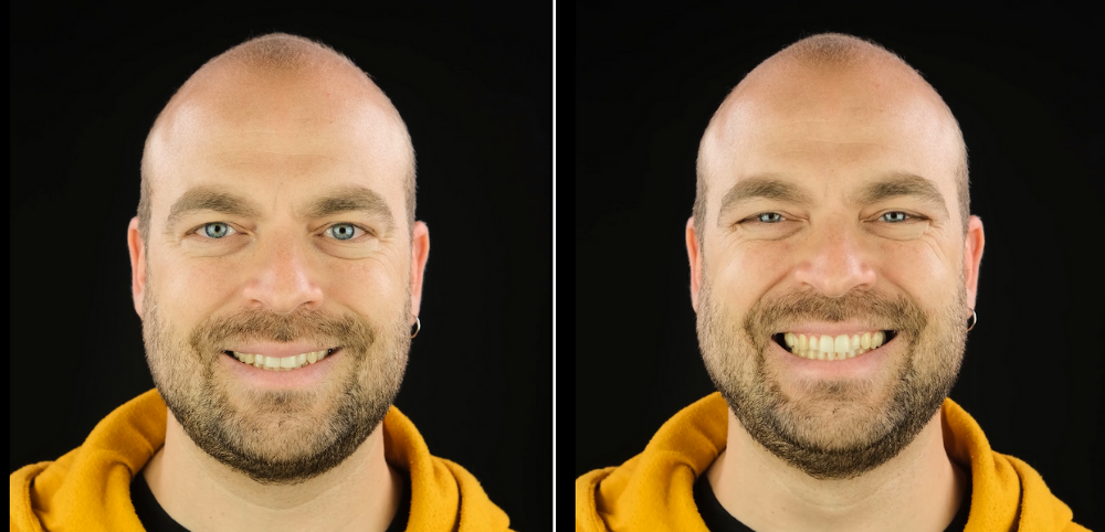 Darwin, Duchenne e a descoberta do sorriso genuíno ...